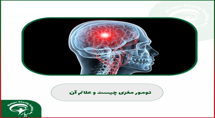 چگونه می توانیم تشخیص دهیم که تومور داریم